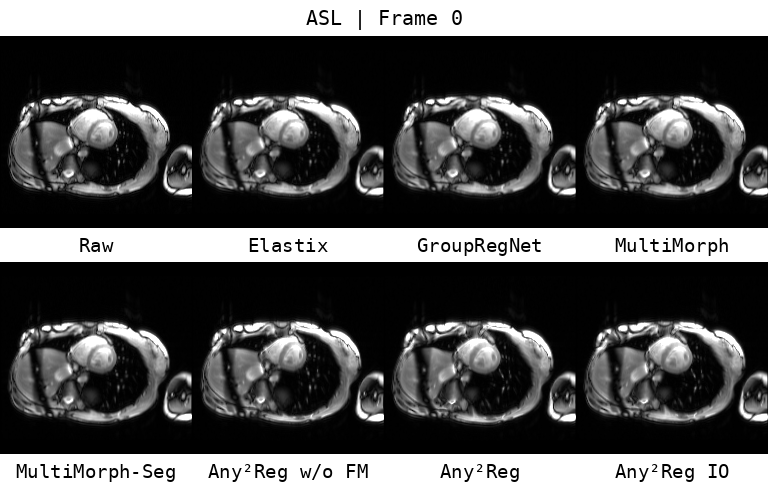 Eight-method registration comparison across ASL frames