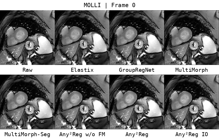 Eight-method registration comparison across MOLLI frames